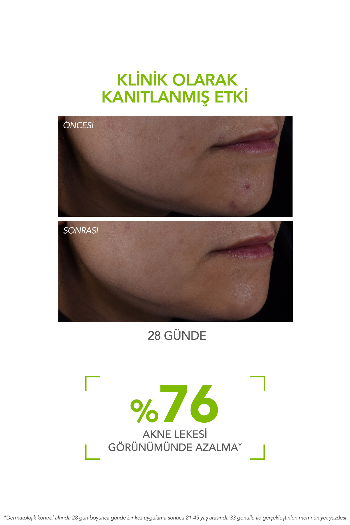 Bioderma Sebium Serum Sivilce, Akne ve Leke Karşıtı Salisilik Asit İçeren Serum 30 ml