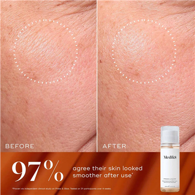 Medik8 Luminous Lift Set-Kırmızı
