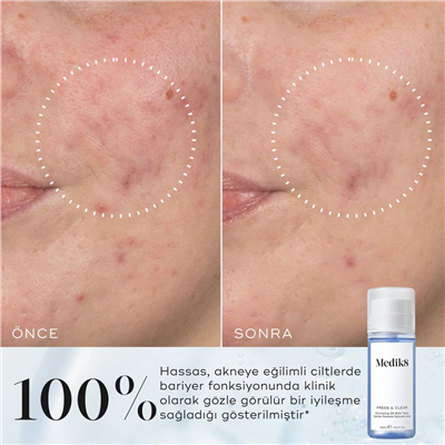 Medik8 Press&Clear 150 Ml P10259