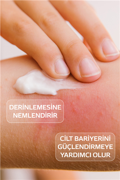 Atocare Vücut Kremi Çok Kuru Ve Atopik Ciltler Için Yoğun Nemlendirici Bebek Çocuk Yetişkin 150 ml