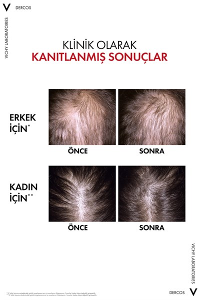 Dercos R.E.G.E.N. Booster Yenilikçi Saç Dökülmesine Karşı Bakım Serumu 90 ml