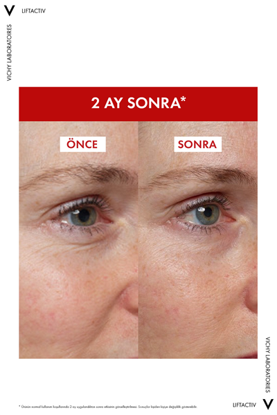 Liftactiv Collagen Specialist 16 Bonding Serum 30ml