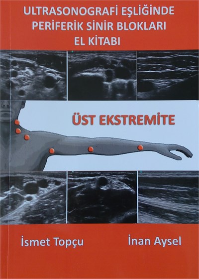 Ultrason Eşliğinde Periferik Sinir Blokları El Kitabı
