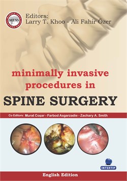 Minimally Invasive Procedures In Spine Surgery