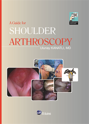 A Guide for Shoulder Arthroscopy