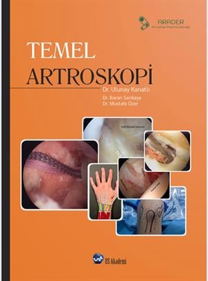Temel Artroskopi