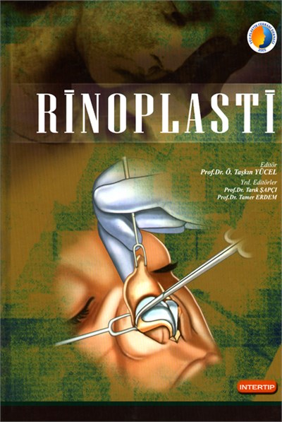 Rinoplasti