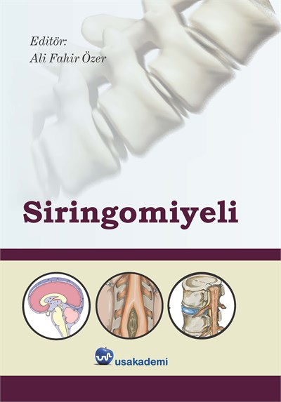 Siringomiyeli