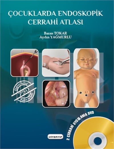 Çocuklarda Endoskopik Cerrahi Atlası Kitap ve 2DVD