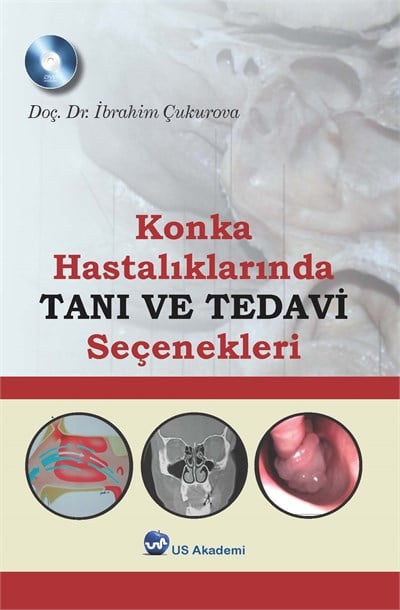 Konka Hastalıklarında Tanı Ve Tedavi Seçenekleri  Kitap ve DVD