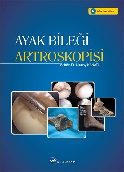 Ayak Bileği Artroskopisi