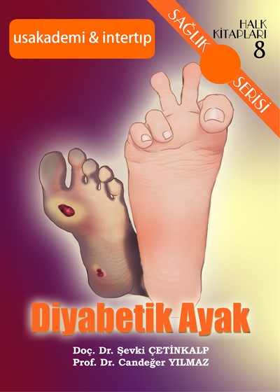Diyabetik Ayak