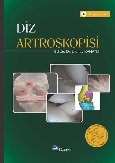 DİZ ARTROSKOPİSİ