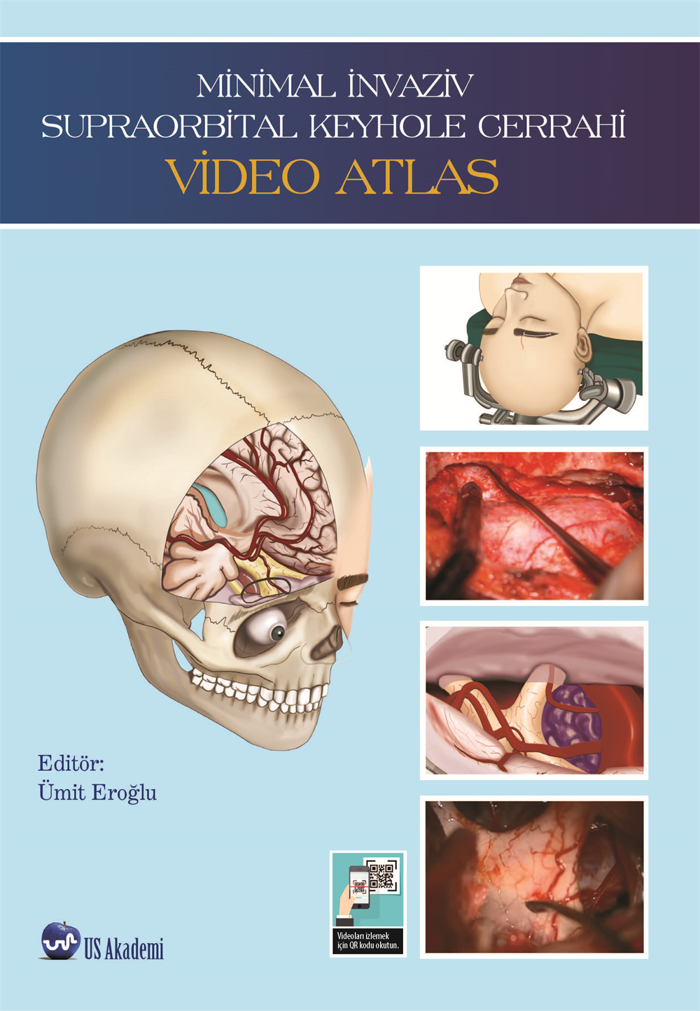 Minimal İnvaziv Supraorbital Keyhole Cerrahi VİDEO ATLAS