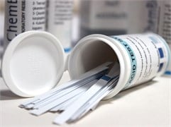 Klor Test Şeridi