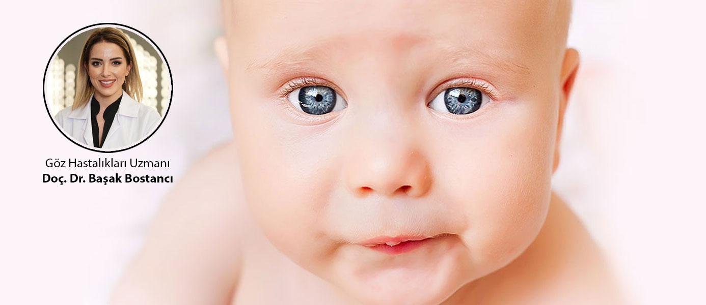 Bebeklerde Doğuştan Göz Kanalı Tıkanıklığı - Welcome Baby Blog