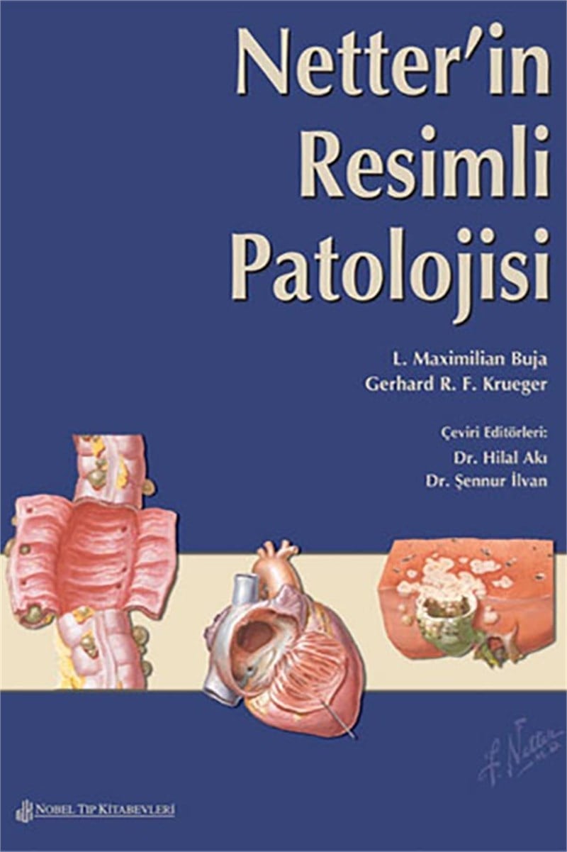 Netter'in Resimli Patolojisi