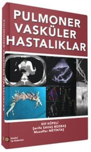 Elif KüpeliMedizinwissenschaftPulmoner Vasküler Hastalıklar