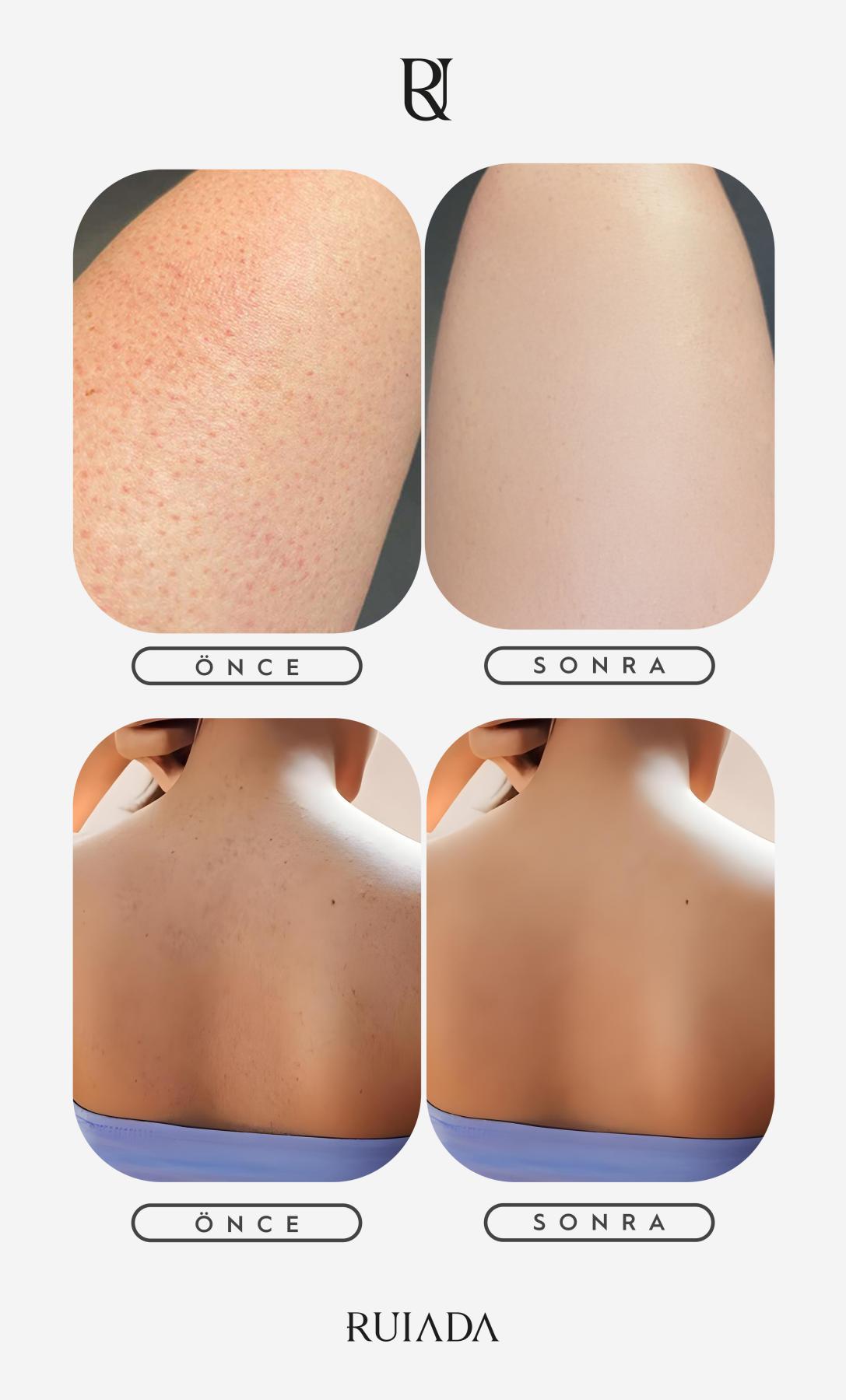 Flowers Series +50 Factor %100 Floş Ipek Ince Banyo Duş Kesesi Peeling Eldiveni (WHİTE)