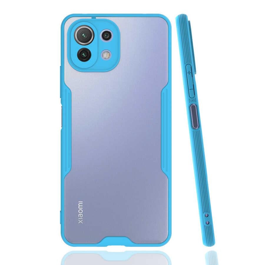 Xiaomi Mi 11 Lite Kılıf Zore Parfe Kapak