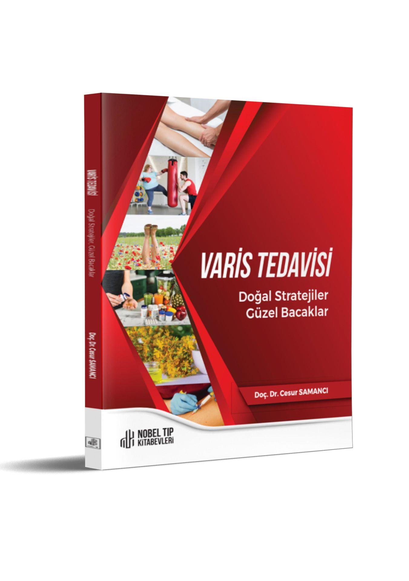 Varis Tedavisi Doğal Stratejiler,Güzel Bacaklar
