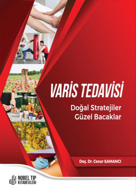 Varis Tedavisi Doğal Stratejiler,Güzel Bacaklar
