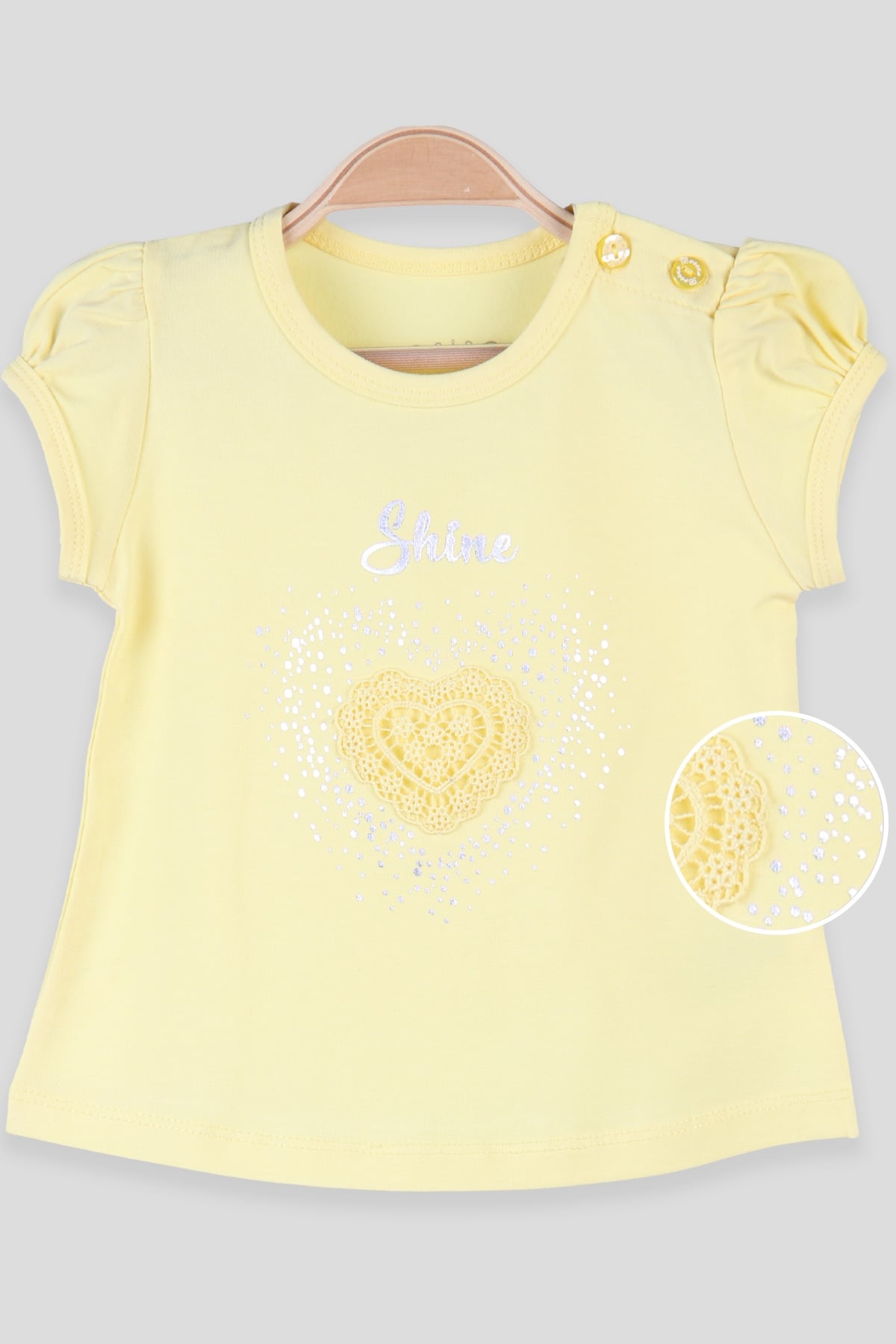 Breeze Kız Bebek Tişört Dantelli Baskılı  Sarı (9 Ay-3 Yaş)