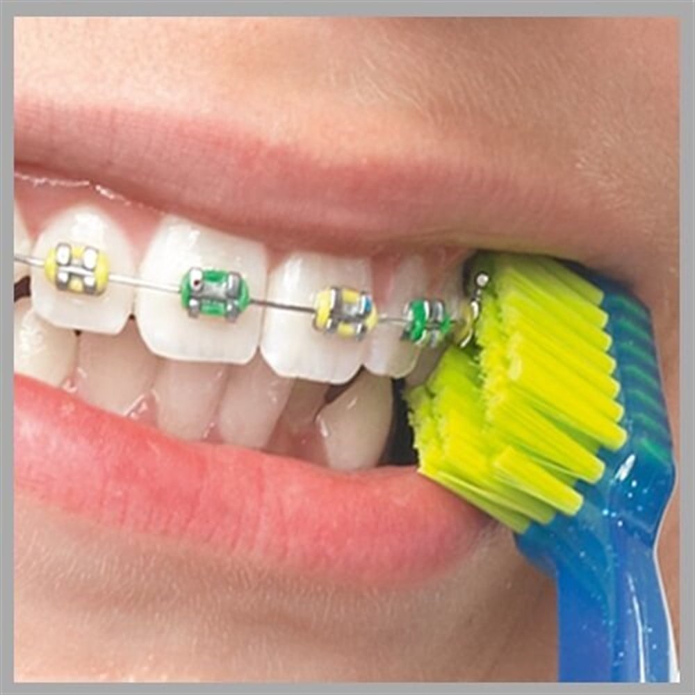 Curaprox CS 5460 Ortho Diş Fırçası