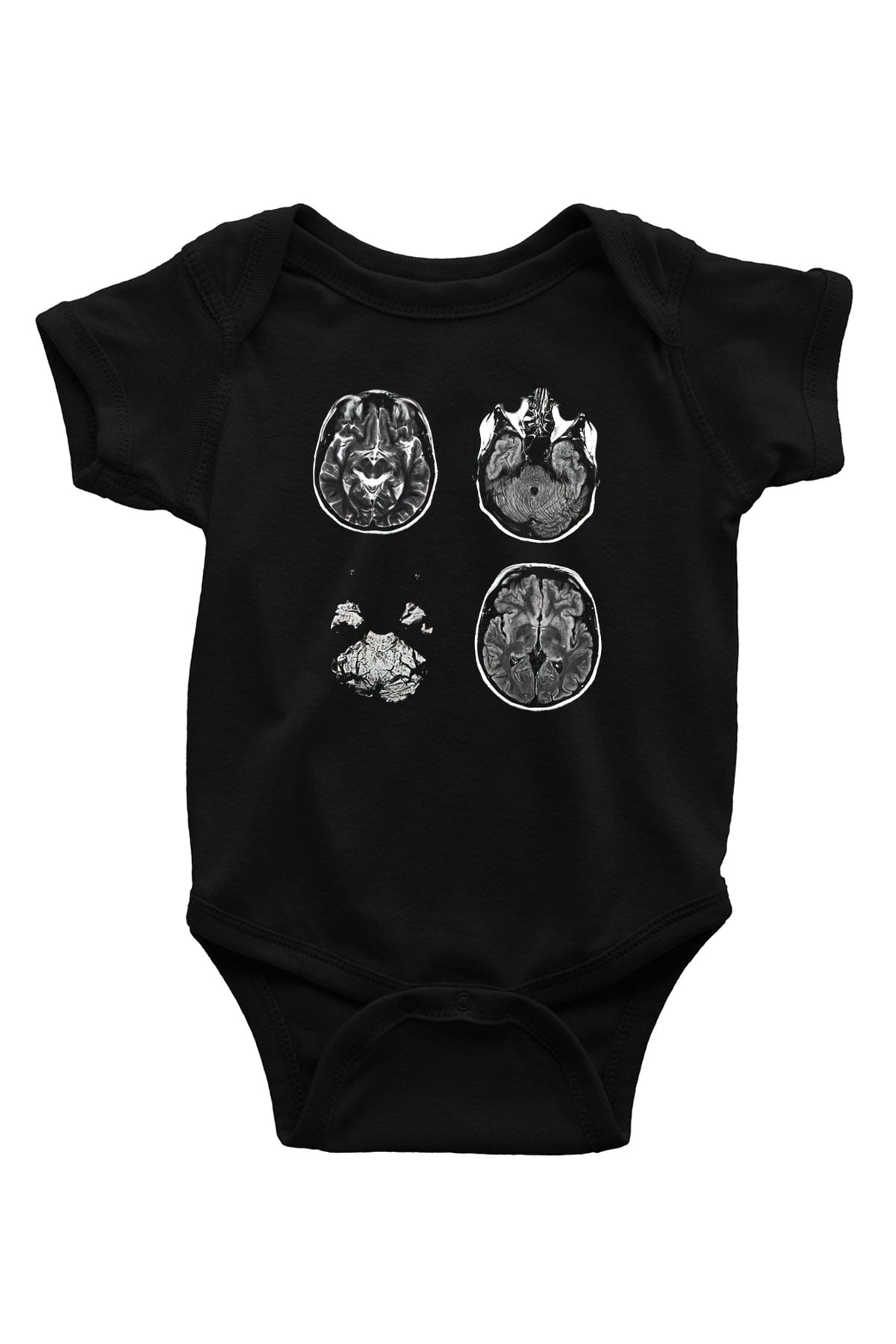 Tıp Bayramı Baskılı Unisex Siyah Bebek Body - Zıbın