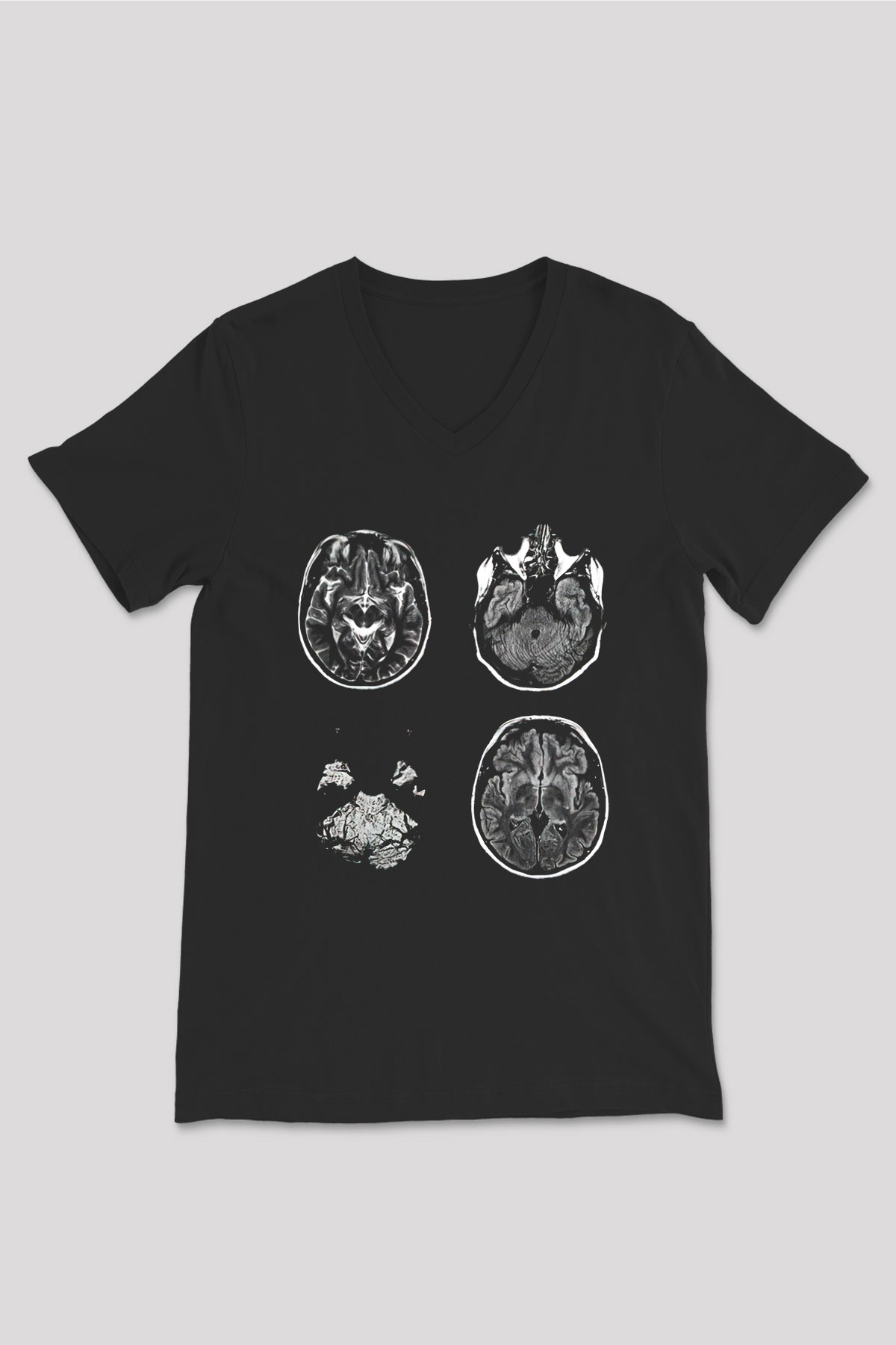 Tıp Bayramı Baskılı Unisex Siyah V Yaka Tişört - Tshirt
