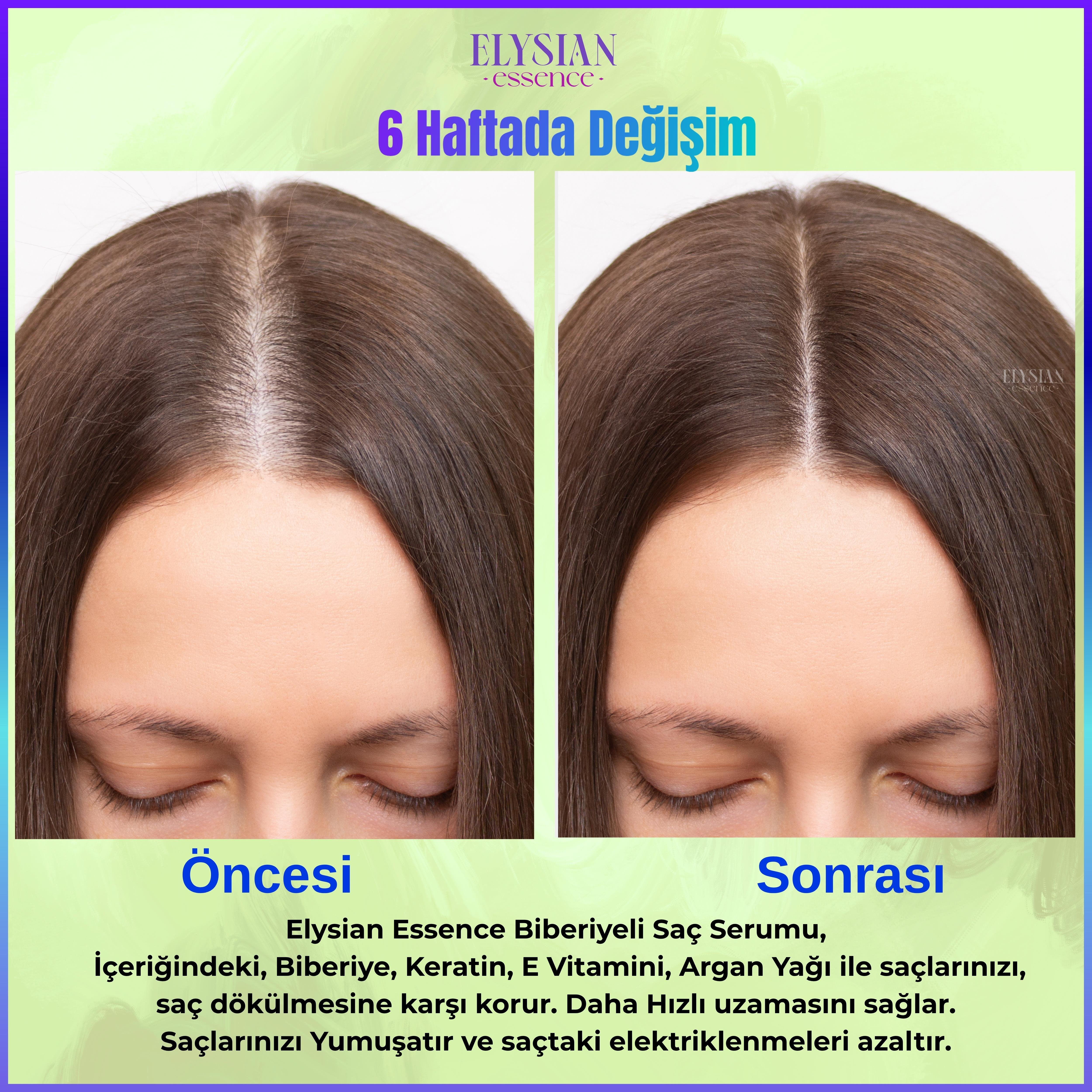 Elysian Essence Biberiyeli Saç Serumu Hızlı Uzama Etkili ve Dökülmeye Karşı - Organik Argan Yağı, Vitamin E, Keratin