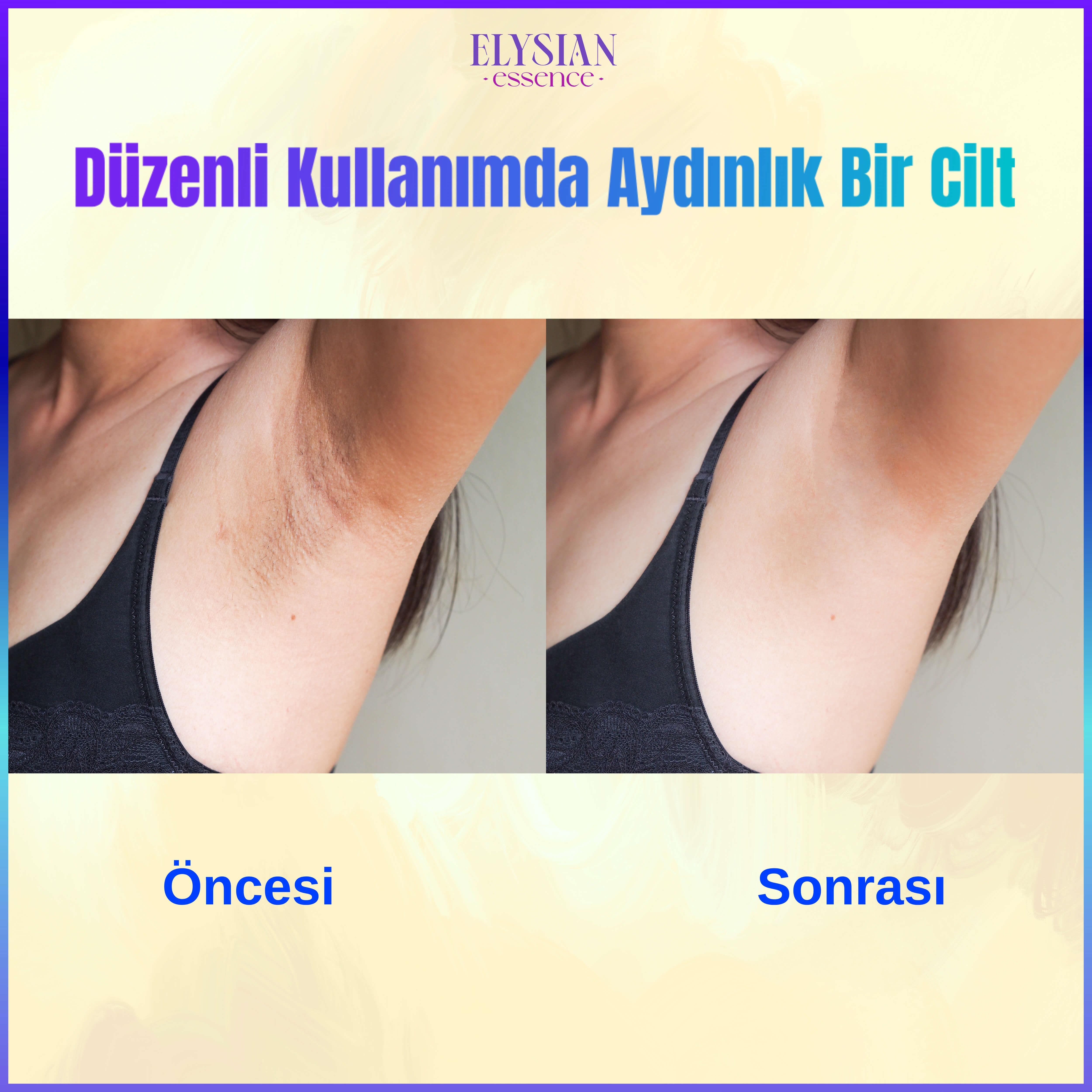 Elysian Essence Cilt Beyazlatıcı | Kararma Giderici Krem - Genital Bölge, Koltuk Altı, Bikini Bölgesi, Dirsek ve Vücut 100 ml