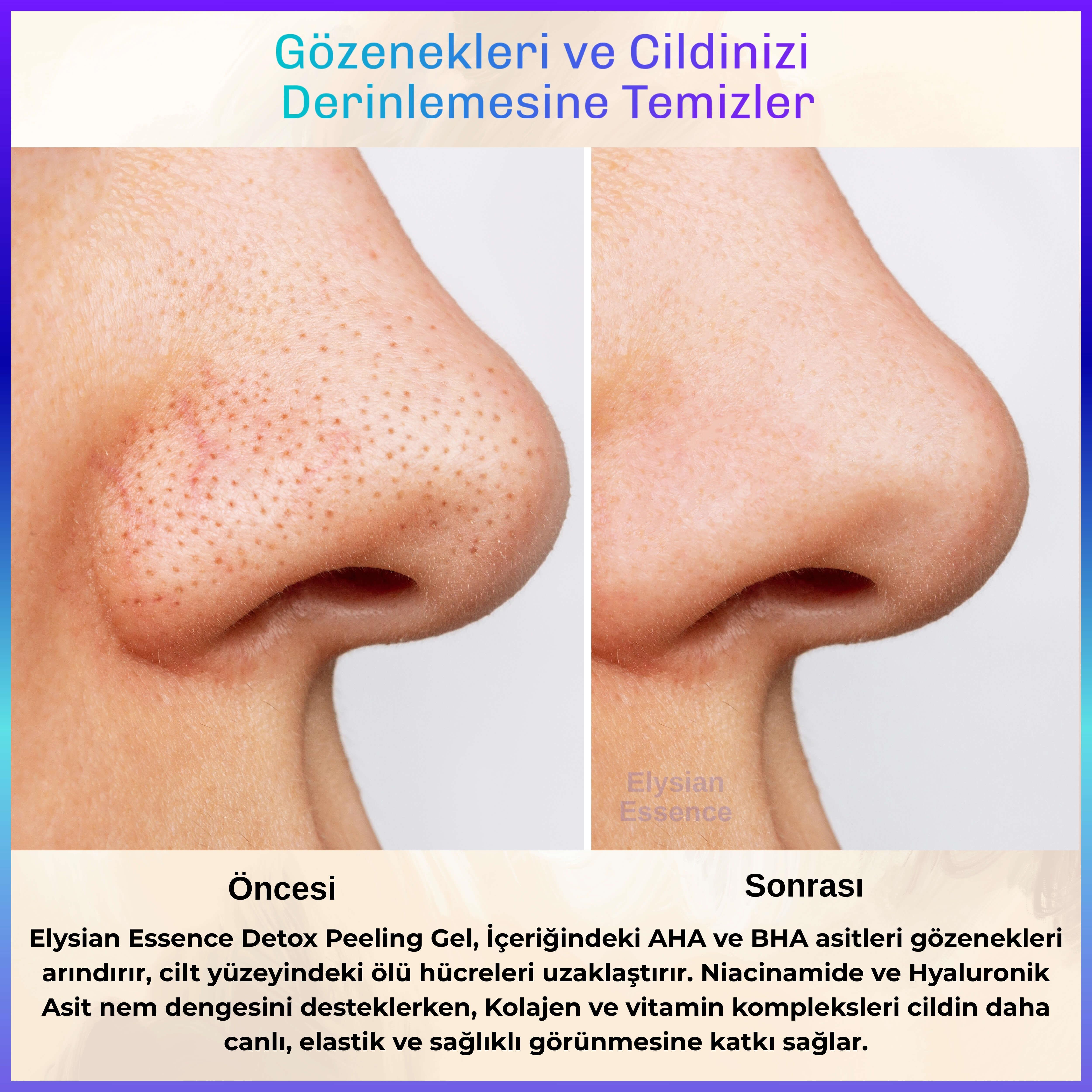 Elysian Essence Detox Peeling Jel 125 ml | Ölü Hücre Arındırıcı Temizleme Jeli | Yüz Ve Vücut Temizleyici | AHA BHA, Vitamin C, Niacinamide