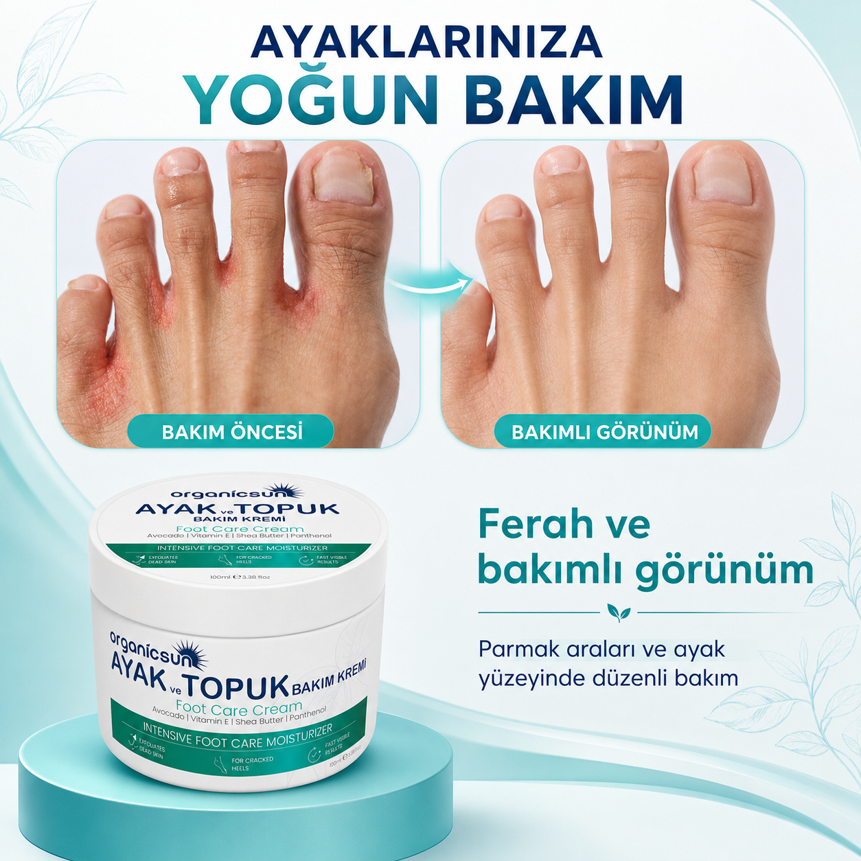 Organicsun Ayak ve Topuk Çatlak Bakım Kremi 100ml - Ayak Kokusu, Tırnak Bakımı Avokado ve Shea Yağlı Yoğun Nemlendirici