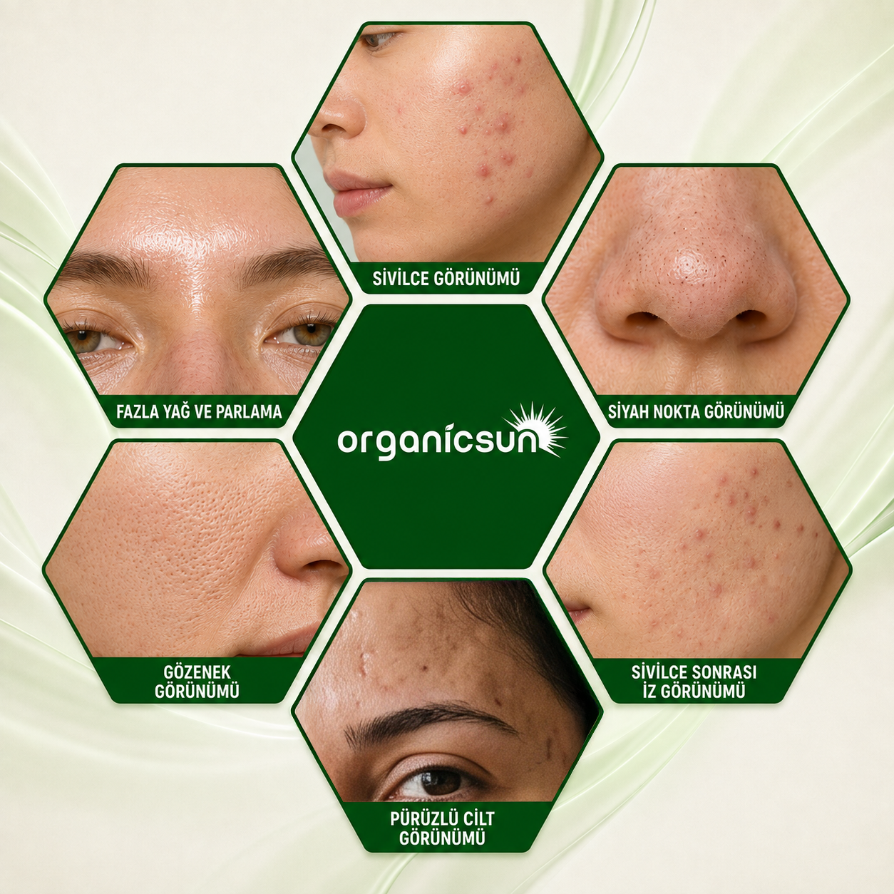 Organicsun Çay Ağacı ve Propolisli Akne ve Sivilce Karşıtı Cilt Bakım Kremi – Siyah Nokta ve Leke Görünümü Bakımı 50 ml