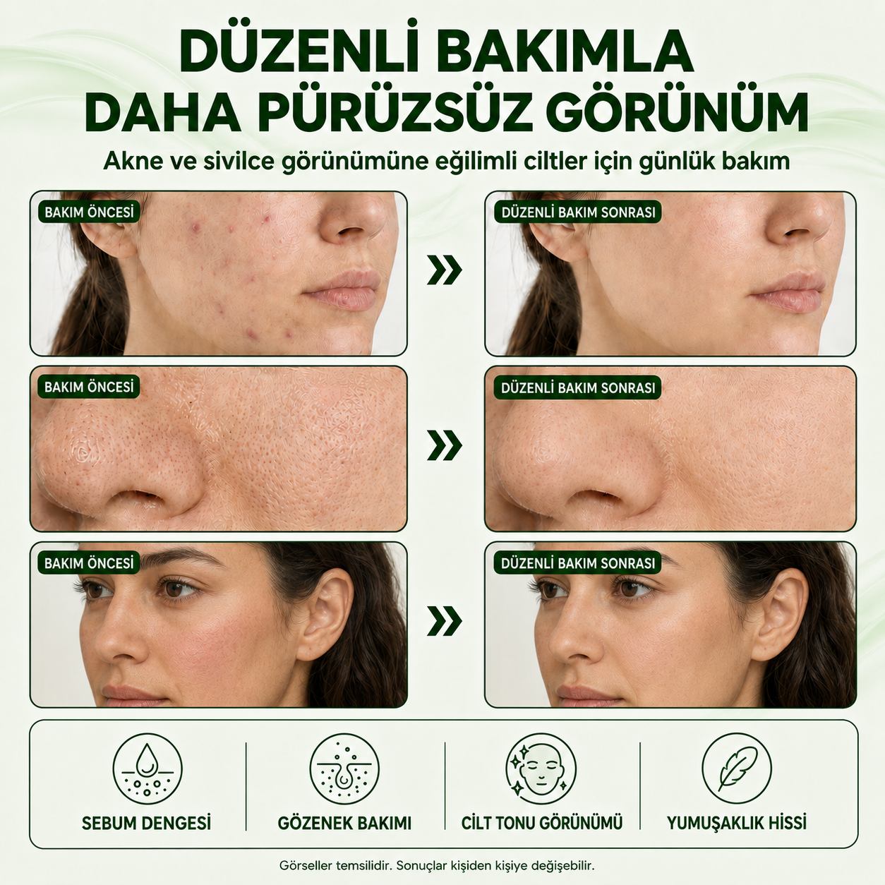 Organicsun Çay Ağacı ve Propolisli Akne ve Sivilce Karşıtı Cilt Bakım Kremi – Siyah Nokta ve Leke Görünümü Bakımı 50 ml