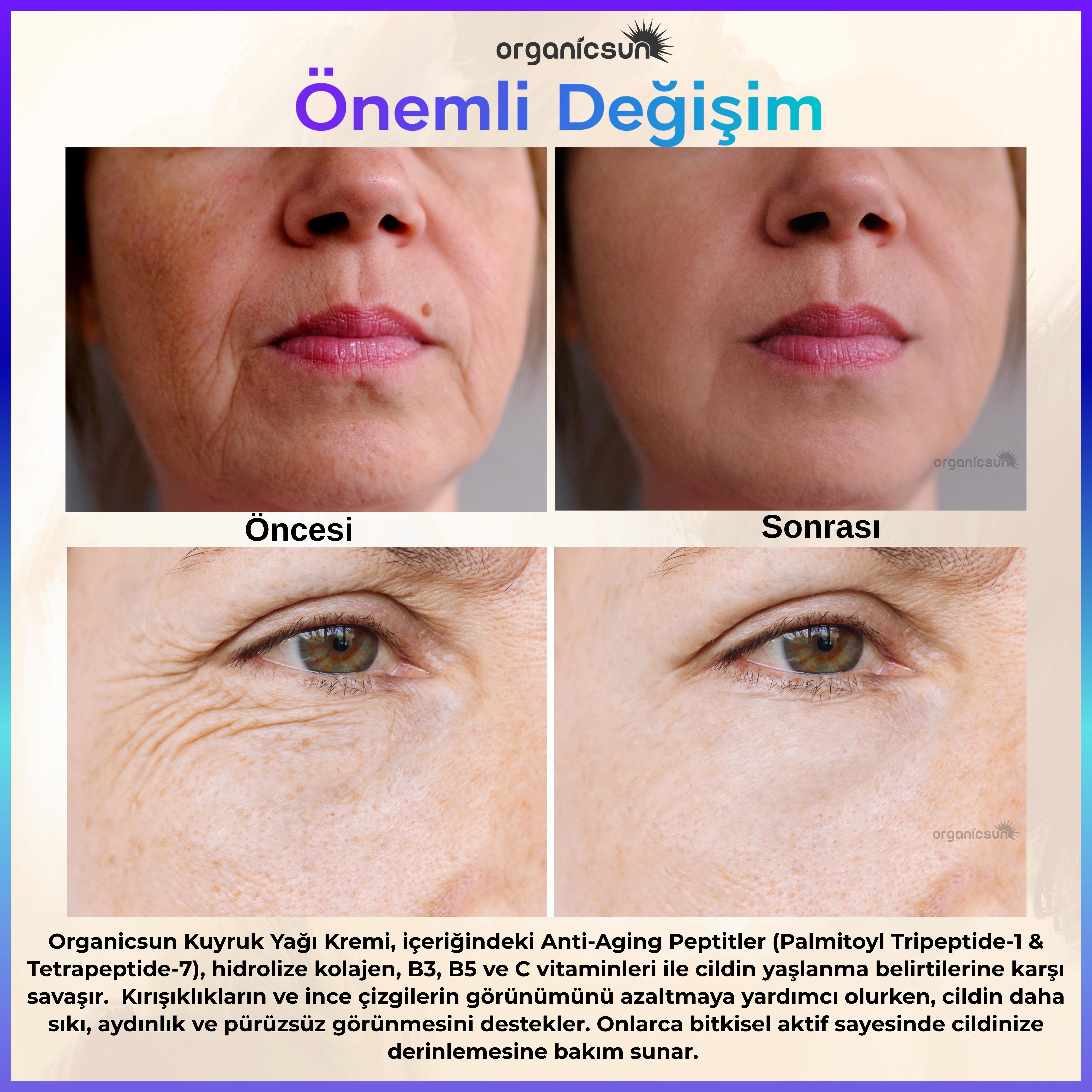 Organicsun Kuyruk Yağı Kremi | Kırışıklık & Yaşlanma Karşıtı Anti Aging Yüz Bakım Kremi 50ml - Collagen İlaveli, Nemlendirici Etki