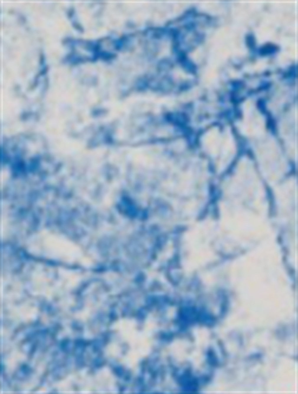 57504 SB Desenli Liner - Parlak