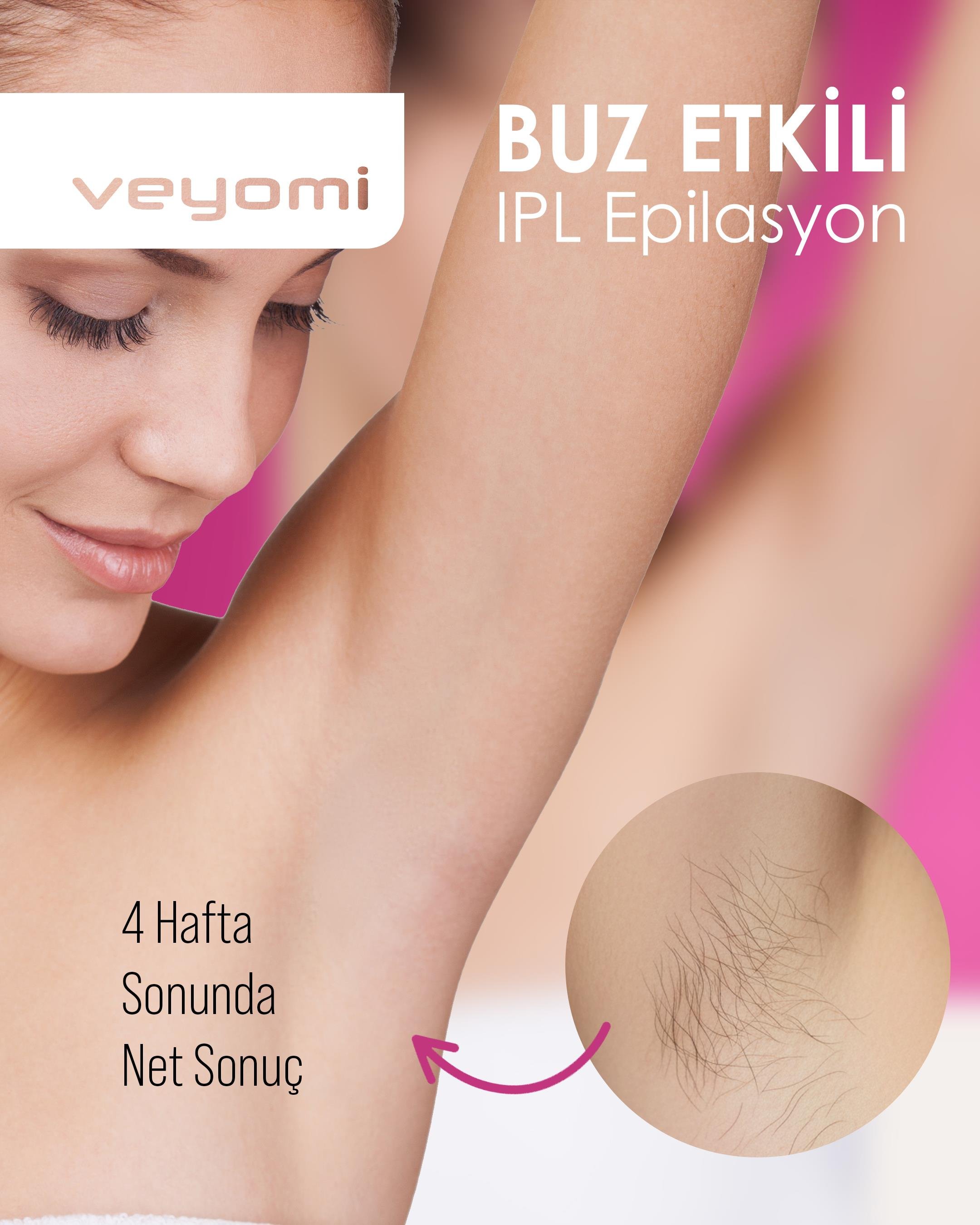 Veyomi Y-1105 Buz Lazer Epilasyon Cihazı