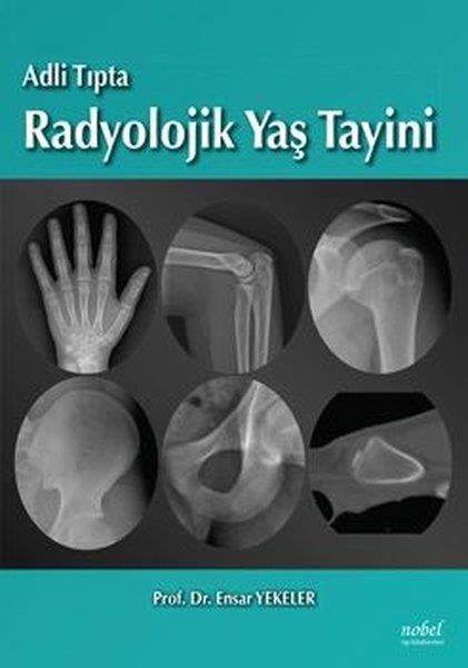 KolektifTıpAdli Tıpta Radyolojik Yaş Tayini