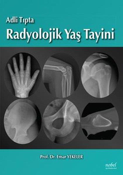KolektifTıpAdli Tıpta Radyolojik Yaş Tayini