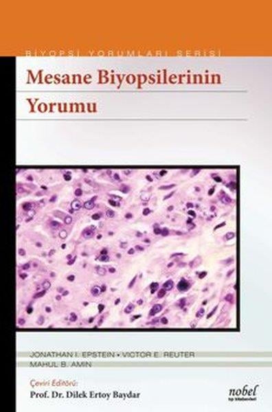 KolektifTıpBiyopsilerin Yorumu: Mesane