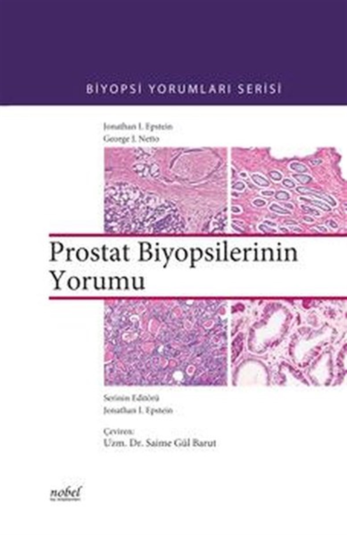 KolektifTıpBiyopsilerin Yorumu: Prostat