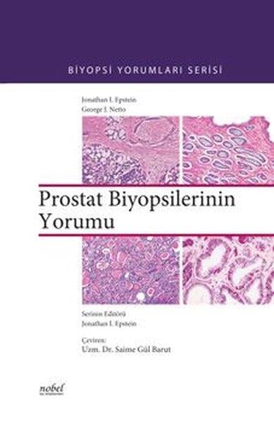 KolektifTıpBiyopsilerin Yorumu: Prostat
