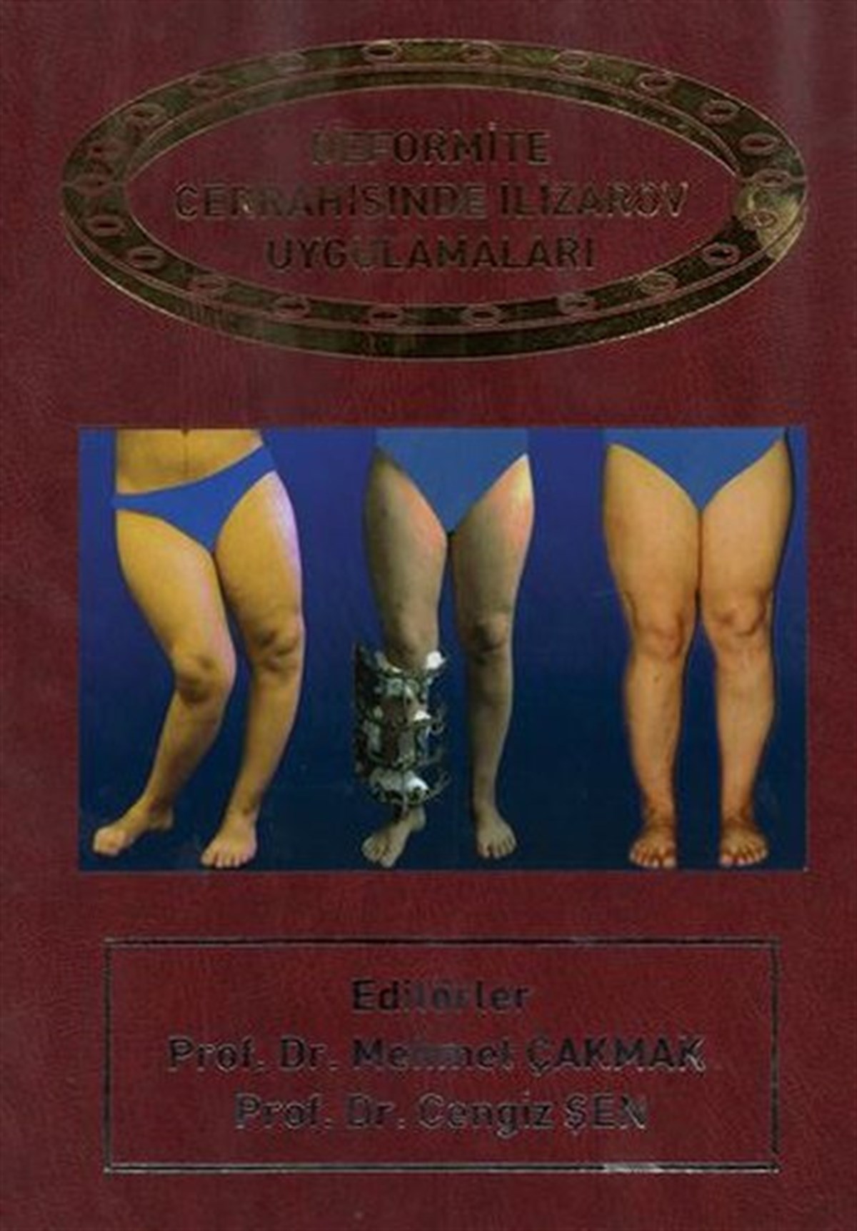 KolektifTıpDeformite Cerrahisinde İlizarov Cerrahisi