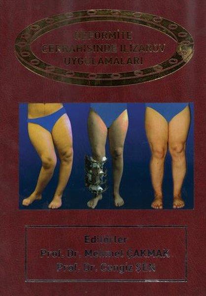 KolektifTıpDeformite Cerrahisinde İlizarov Cerrahisi