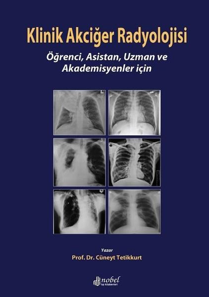 Prof.Dr. Cüneyt TetikkurtTıpKlinik Akciğer Radyolojisi