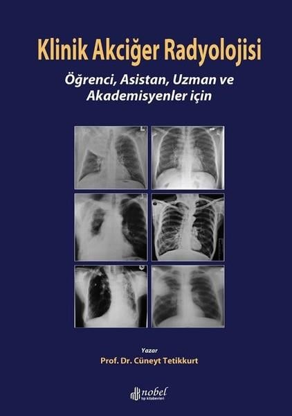Prof.Dr. Cüneyt TetikkurtTıpKlinik Akciğer Radyolojisi