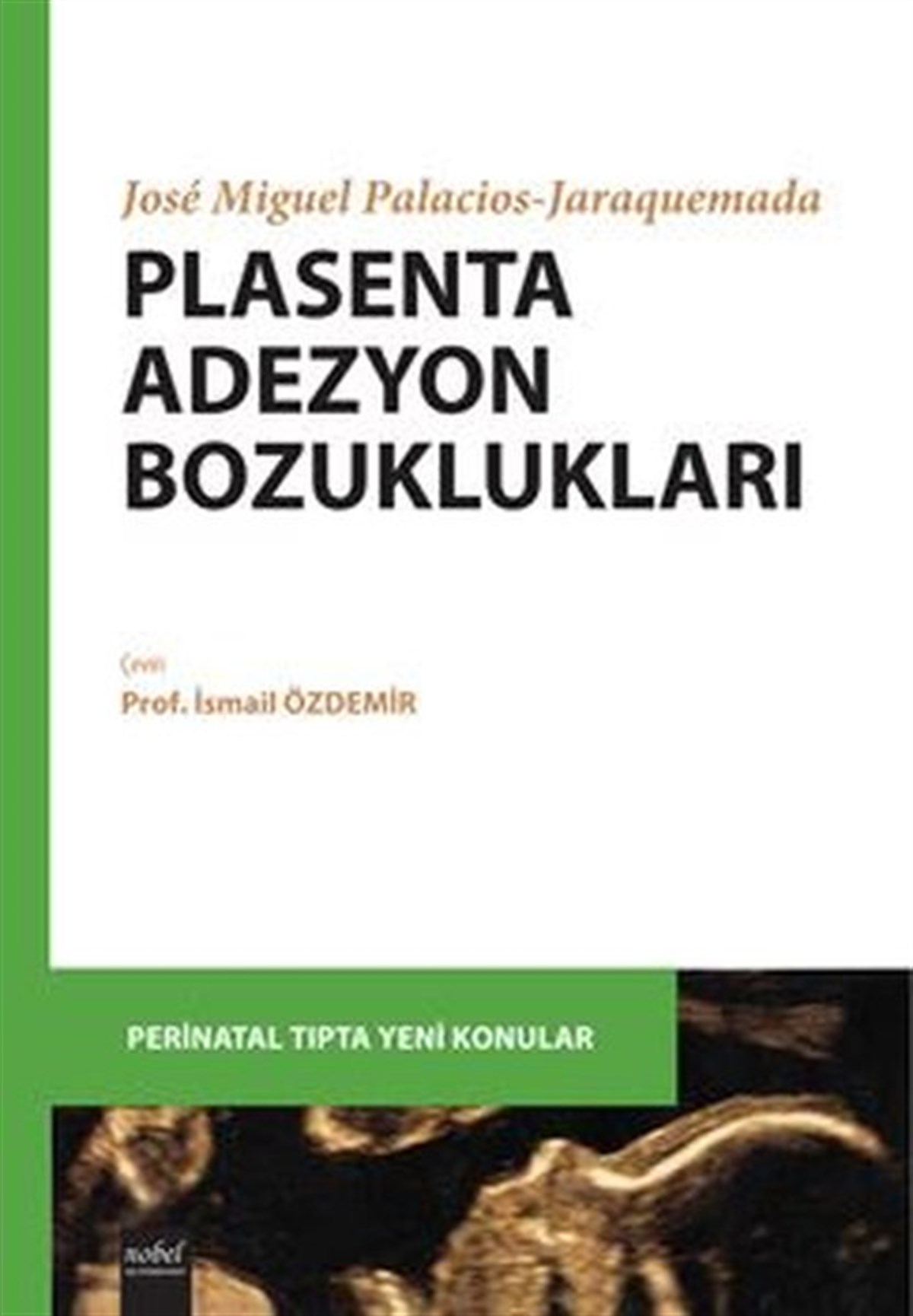 KolektifTıpPlasenta Adezyon Bozuklukları