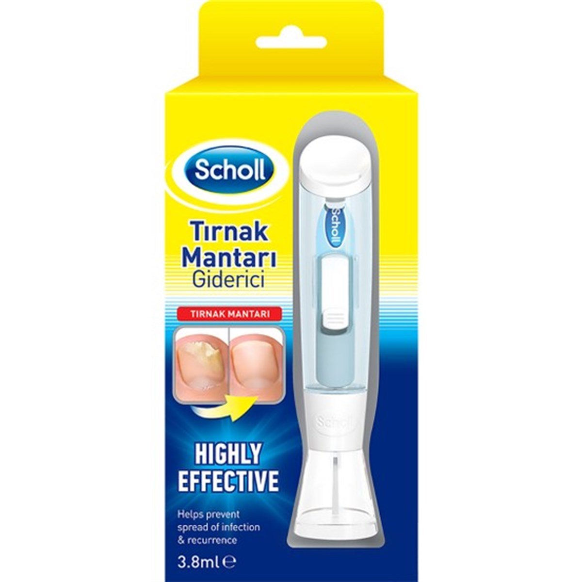 Scholl Tırnak Mantar Tedavisi Mantar Giderici